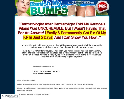 100% Natural Keratosis Pilaris Cure - BanishMyBumps.com