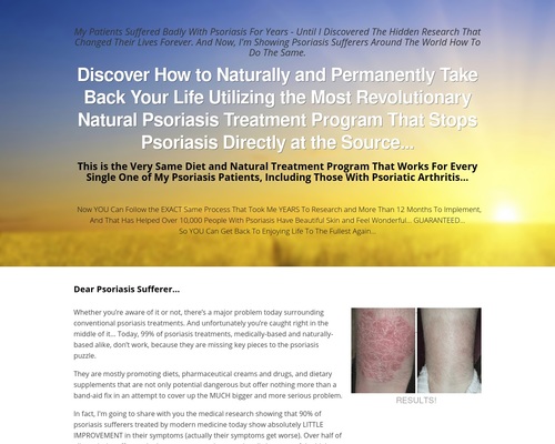 Natural Psoriasis Treatment Program - The Psoriasis Program