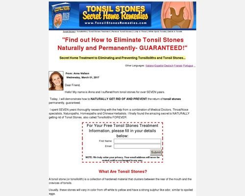 Tonsil Stones Secret Home Remedies